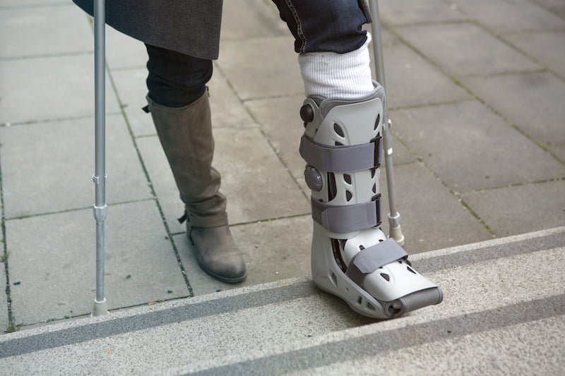 closeup of woman walking with a plaster cast and crutches